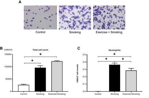 Figure 3 Total cell count and proportion of neutrophils in the BALF.