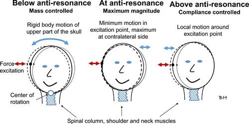 Figure 10 Illustrations of skull motions proposed for frequencies below, at and above the anti-resonance frequency typically located at 150 Hz.