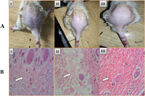 Figure 8. Histopathological results of (I) Normal: Skin cells are intact and no sign of infiltration, (II) Formalin: Damaged skin cells with infiltration, (III) AmB-PTM-NIO-Gel: Skin cells are intact with no sign of infiltration.