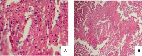 Figure 2 Images of the liver tissue injected with the normal size acetaminophen, (A) with high resolution, and (B) with low resolution.