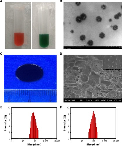 Figure 2 The morphology and characterization of NDIMH.Notes: (A) Representative photographs of DOX and ICG nanoparticles dispersed in PBS at ambient temperature (red represents DOX nanoparticles, and green represents ICG nanoparticles). (B) TEM image of nanoparticles (scale bar represents 1 µm, magnification ×8,000). (C) General morphological map of NDIMH. (D) SEM image of NDIMH (scale bar represents 100 µm, magnification ×250). (E) The size distribution of DOX nanoparticles. (F) The size distribution of ICG nanoparticles. (G) The nano DOX release profile of NDIMH at varied time points. (H) The nano ICG release profile of NDIMH at varied time points.Abbreviations: DOX, doxorubicin; ICG, indocyanine green; MMP, matrix metalloproteinase; NDIMH, nano DOX-ICG MMP-responsive hydrogel; SEM, scanning electron microscopy; TEM, transmission electron microscopy.