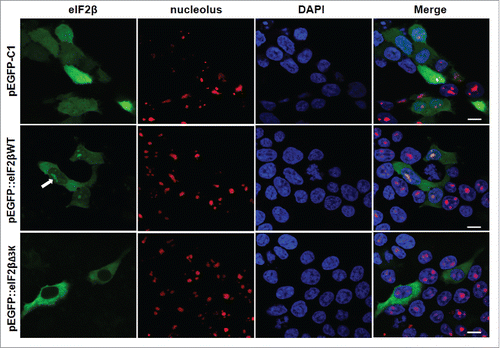 Figure 6. Subcellular localization of eIF2βWT and eIF2βΔ3K in Hek293 cell lines. Cells were transfected with empty vector pEGFP-C1 (n = 73) or plasmids carrying the fusion proteins pEGFP::eIF2βWT (n = 210) or pEGFP::eIF2βΔ3K (n = 173). Twenty-four hours after transfection, cells were fixed and submitted to immunocytochemistry using anti-nucleolus human serum. DAPI was used to stain the nucleus. The subcellular localization was analyzed by confocal microscopy. Arrow shows eIF2β nucleolar staining. (n) is the number of observed cells. The scale bars represent 10 µm.