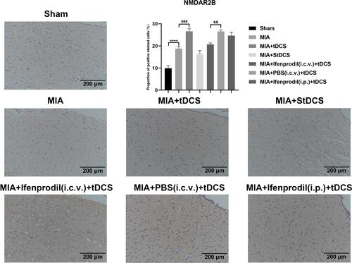 Figure 3 Immunohistochemical staining for NMDAR2B in all groups. Scale bars: 200 µm. The proportion of positive stained cells were presented as the mean ± SEM (n=4/group). ****P<0.001, MIA group vs Sham group; ###P<0.001, MIA+tDCS group vs MIA group; &&P<0.01, MIA+PBS (i.c.v.)+tDCS vs MIA+Ifenprodil (i.c.v.)+tDCS group.