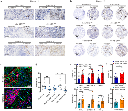 Figure 1. Spatial distribution of CD8+ T cells, NCR1+ NK cells, and PD-L1+ cells in NB patients.