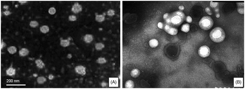 Figure 3. Microscope photograph (×10 000) of CLC (A) at The molar ration of sodium cholesterol sulfate and phospholipid of 1:1.5; (B) at the molar ration of sodium cholesterol sulfate and phospholipid of 1:2.5.