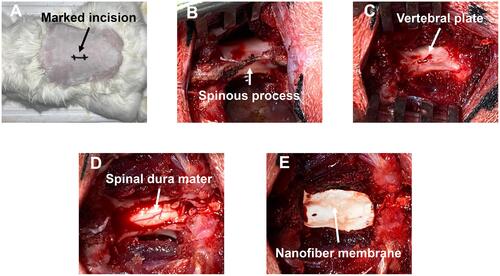 Scheme 2 Modeling process. (A) Preoperative preparation of the incision site; (B) exposed lamina; (C) removed spinous process; (D) removed lamina; (E) spinal dura mater covered by NFm.