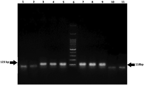 Figure 1. Agarose gel electrophoresis of PCR products from DNA of CRMs samples containing CaMV 35 S (123 bp) and NOS (118 bp). Lane 1: no template control; Lanes 2–5: CRM soy 0%, 0.1%, 0.5%, 1%; Lane 6: 100 bp DNA ladder; Lanes 7–10: CRM maize 0%, 0.1%, 0.5%, 1%; Lane 11: no template control