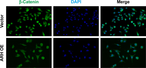 Figure S1 ARHGAP30 inhibited nuclear translocation of β-catenin.