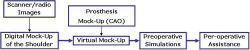 Figure 2. Computer-aided surgery system for placement of shoulder prosthesis.