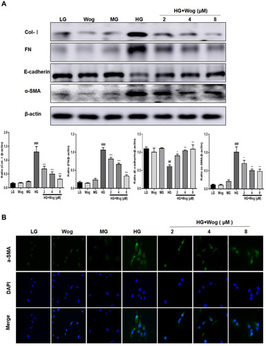 Figure 7 Wogonin reduces the ECM in HG-treated HK-2 cells. (A) Western blot analysis of Col-I, FN, E-cadherin and α-SMA in HK-2 cells. (B) IF of α-SMA (green). Nuclei were counterstained with DAPI (blue). Results represent means ± SEM for three independent experiments. ##p < 0.01, ###p < 0.001 VS LG. *p < 0.05, **p < 0.01, ***p < 0.001 VS HG.