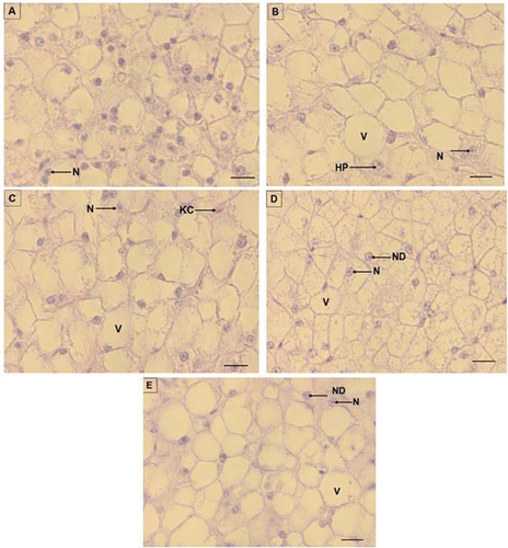 Figure 2. Liver micrographs of O. mossambicus fed diets with Stinkbug meal as a fishmeal replacement. A (control: 0%), B (diet D2; 25%), C (diet D3: 30%), D (diet D4: 50%), and E (diet D5; 75%). V: vacuolisation, N: nucleus, ND: nuclear displacement, HP: Hepatic plate, KC: Kupffer cell. Scale bar: 20 µm.