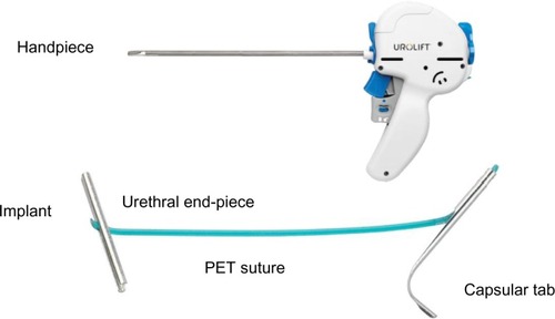 Figure 2 UroLift® system handpiece and implant.