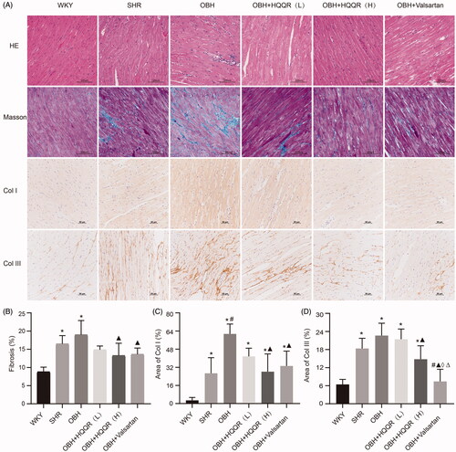 Figure 4. HQQR treatment alleviated myocardial fibrosis. (A) Representative photomicrographs of HE, Masson’s staining, and IHC (Col I and Col III) of the myocardium of rats. (B) The area of fibrosis in the myocardium was calculated using the Image J software. (C) The area of Col I in the myocardium was calculated using the Image J software. (D) The area of Col III in the myocardium was calculated using the Image J software. *p < 0.05 vs. WKY group; #p < 0.05 vs. SHR group; ▲p < 0.05 vs. OBH group; ⋄p < 0.05 vs. OBH + HQQR(L) group; Δp < 0.05 vs. OBH + HQQR(H) group.