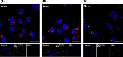 Figure 4. Confocal microscopy images of PEGylated liposomes (A), EK-(EK)4/PEGylated liposomes (B), and KK-(EK)4/PEGylated liposomes (C) (at a modification amount of 6%) in A549 cells. The cells were treated with 25 µM NBD-labeled liposomes for 3 h. Nuclei were stained with Hoechst 33342 (blue). Late endosomes/lysosomes were stained with LysoTracker Red (red). Liposomes have been indicated as green fluorescence. Scale bar = 20 μm.