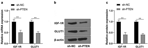 Figure 5. PTEN raised IGF-1 R/GLUT1 expression. (a) IGF-1 R/GLUT1 mRNA level in OGD/R-induced N2a cells after sh-PTEN transfection detected using RT-qPCR; (b-c) The protein level of IGF-1 R/GLUT1 in OGD/R-induced N2a cells after transfection of sh-PTEN detected by WB. Cell experiment was conducted 3 times. Data were expressed as mean ± SD and analyzed by independent t test. **P < 0.01.