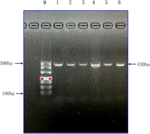 Figure 1 Gel electrophoresis of PCR extended gene fragments of MY09B SNP locus rs962917 in each group.