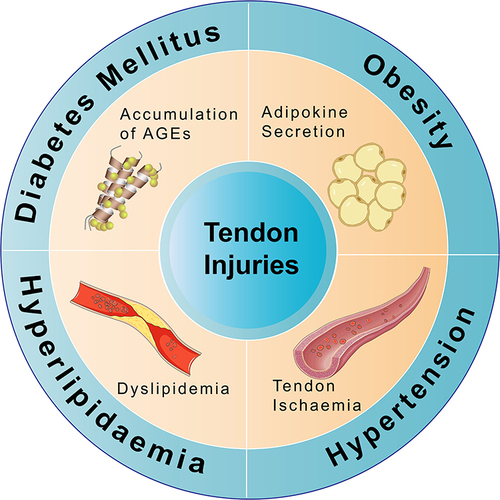 Figure 1 The effects of different components of MS on tendon injuries. In diabetes, the accumulation of AGEs significantly impairs tendon adhesion healing, exhibits poor histological characteristics with hyperglycemia, reduces the failed load, and diminishes the stiffness of the reparative structure, consequently resulting in tendon injuries. Obesity increases the risk of tendon injuries, which is closely associated with adipokine secretion. Hyperlipidemia results in dyslipidemia, primarily due to the accumulation of cholesterol by-products, which can impair normal blood circulation in the tendons, leading to tendon injuries. Hypertension-induced peripheral blood supply insufficiency leads to ischemia of the tendons, increasing the risk of tendon injury.