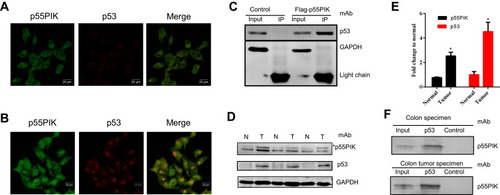 Figure 1 Interaction of p55PIK with p53 in cancer cells. (A and B) p55PIK protein and p53 protein are co-localized in the nucleus in HeLa cells without or with UV treatment for 3 min, respectively. (C) Co-immunoprecipitation of transiently expressed flag-p55PIK and p53 protein in HEK293A cells. Control: the cells were transfected with default plasmid; Flag-p55PIK: the cells were transfected with a plasmid harboring Flag-p55PIK. (D) Detection of p55PIK and p53 protein expression in normal tissue samples and tumor samples of colon cancer patientsNotes: *The band indicated p55PIK protein. (E) Comparison of p55PIK and p53 expression in normal colon tissue samples and colon tumor samples. Data are mean ± SEM. N = 3 pairs of samples; *p < 0.05 for normal vs tumor samples. (F) p53 protein interacted with p55PIK protein in tumor tissue samples and normal tissue samples from colon cancer patients.Abbreviations: N, normal cells; T, tumor cells.