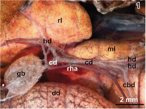 Figure 1. Gallbladder and bile duct system in adult male Xenopus laevis Daudin. Stereomicroscopy. Ventral view. Note the right hepatic artery (rha) which abuts the cystic arteries. cbd common bile duct, cd cystic duct, dd duodenum, gb gallbladder, hd hepatic duct, ml median lobe of liver, rl right lobe of liver.