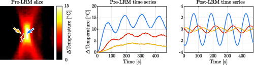 Figure 7. Magnified temperature map of the focal region for experiment C1 (left). The measured temperature at the locations indicated by the corresponding colored arrows (middle). The LRM corrected temperature transformed back into the time-domain for the corresponding locations (right).