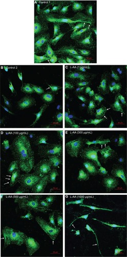 Figure 9 Immunofluorescence microscopy images of endothelial cells for different doses of L-AA (A–G) (scale bar indicates 50 μm).