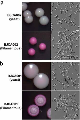 Figure 2. Colony and cellular morphologies of strains BJCA002 (a) and BJCA001 (b). Yeast-form or filamentous cells of C. auris were plated on YPD medium and incubated at 25°C for 7 days. Scale bar, 10 μm