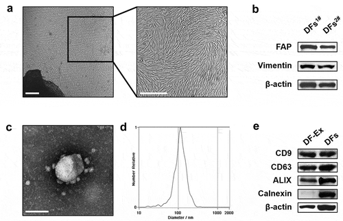 Figure 1. Isolation and characterization of DFs and DF-Ex. (a) The morphology of primary DFs was observed using an optical microscope (scale bar = 250 μm). (b) DFs were identified with FAP and Vimentin through western blotting. (c) The morphology of DF-Ex was observed using a transmission electron microscope (scale bar = 100 nm). (d) The size distribution of DF-Ex was detected through nanosight tracking analysis. (e) The exosomal markers were analyzed through western blotting