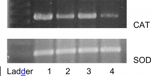Figure 4. RT-PCR analysis of CAT and SOD expression in liver tissues on agarose gel: (1) control; (2) Halimeda opuntia 80 mg/kg, (3) GA, and (4) CCl4.