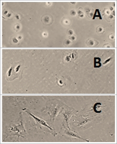 Figure 1. Rat liver myofibroblasts on plastic. Rat liver MFB were cultured on a plastic dish. (A) Cells 1 h, (B) 4 h and (C) 24 h after plating. The cells were initially rounded and then spread on the hard surface (Peterová and Kanta, unpublished results).