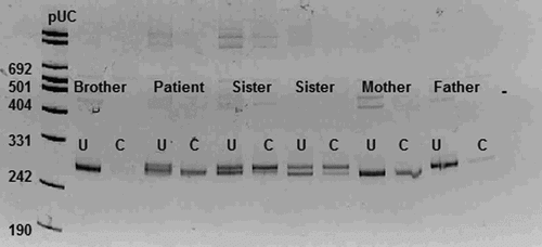 Figure 4.  X-chromosome inactivation pattern of the family. Line 1, marker; line 2 and 3: brother of the patient; line 4 and 5, the patient; line 6,7,8,9, sisters of the patient; line 10 and 11 mother of the patient; line 12 and 13, father of the patient, and line 13 and 14, negative control. A single allele in the HpaII digested sample indicating non-random X-chromosome inactivation was observed in the patient (U: uncleaved and C: cleaved).