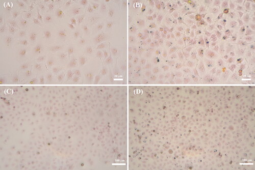 Figure 5. Prussian blue staining of MCF-7 cells: blank group (A, C), 40 μg/mL magnetic Fe3O4@mSiO2-NH2-FA nanocomposites (B, D).