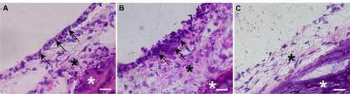 Figure 4 (A–C) Hematoxylin and eosin staining of middle-ear bullae after cell transplantation at postoperative day 7. (A) Normal middle-ear bulla; (B and C) a middle-ear bulla in which the cells were transplanted with PuraMatrix at a density of 5.0 × 105 cells/mL (B) or without PuraMatrix (C). (A) A monolayer structure of middle-ear mucosal epithelium was confirmed on the inner surface of the normal middle-ear bulla (arrows). (B) Epithelioid layer formation was identified on the surface of the subepithelial layer of the recipient middle-ear bulla in which the cells were transplanted with PuraMatrix (arrowheads). (C) No epithelioid layer formation was observed on the surface of the subepithelial layer of the recipient middle-ear bulla in which the cells were transplanted without PuraMatrix.Note: Black asterisks, subepithelial layer; white asterisks, inner bone surface of the middle-ear bulla; scale bars, 20 μm.