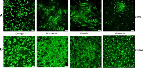 Figure 6 Expression of extracellular matrix proteins. Proteins expressed during cell adhesion ie within 24 hrs (A) and differentiation ie at day 21 (B) were assessed using immunofluorescence assays.