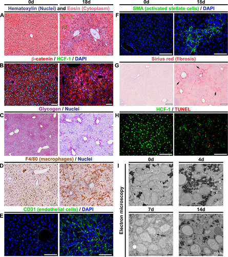 FIG 3 Hcfc1hepKO/Y males display characteristics typical of NASH by 18 days after tamoxifen treatment. (A to H) Comparison of paraffin-embedded sections (A to D and F to H) and cryosections (E) of control livers (0d; left) and Alb-Cre-ERT2tg; Hcfc1hepKO/Y livers 18 days after tamoxifen treatment (right). (A) Hematoxylin (blue) and eosin (pink) staining. Arrows point to hepatocytes with various nuclear sizes. (B) Sections stained with DAPI (blue) together with β-catenin (red) and HCF-1 (green) antibodies. (C) Hepatic glycogen visualized by PAS staining (purple). The sections were also stained with hematoxylin (blue). (D) DAB immunostaining for macrophage marker F4/80 (brown). The sections were also stained with hematoxylin (blue). (E) Cryosections stained with DAPI (blue) and CD-31 antibody (green). (F) Sections stained with DAPI (blue) and smooth-muscle α-actin (SMA; green) antibody. (G) Sections stained with Sirius red. The arrows point to collagen fibers. (H) TUNEL assay of apoptotic cells (red) costained with HCF-1 antibody (green). TUNEL-positive apoptotic cells are shown in red. (I) Electron microscopic images of control liver (0d) and knockout Alb-Cre-ERT2tg; Hcfc1hepKO/Y male liver samples 4, 7, and 14 days after tamoxifen treatment. Scale bars: 100 μm (A to H) and 2 μm (I).