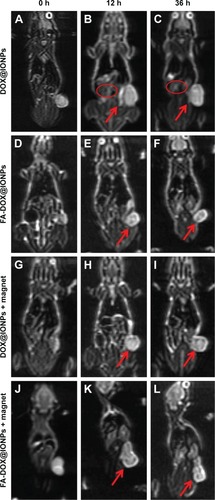 Figure 9 Coronal T2 weighted images of mice after injection at 0, 12, and 36 hours. Coronal T2 weighted images of mice after injection of (A–C) DOX@IONPs; (D–F) FA-DOX@IONPs; (G–I) DOX@IONPs plus magnetic field (magnet); and (J–L) FA-DOX@IONPs plus magnetic field. The red arrows denote the tumor site and red circles denote the liver of the mouse.Abbreviations: DOX, doxorubicin; FA, folic acid; IONP, iron oxide nanoparticle.