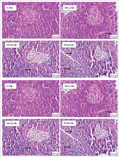 Figure 7. Representative histopathologic features of the pancreas. (H&E stain, black arrows: edema and necrosis, blue arrow: perivascular lymphocyte infiltrations, and inflammatory changes, yellow arrow: pancreatic islet).