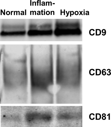Figure 4. Primary human PTEC cultured under disease conditions produce greater numbers of exosomes – defined by CD9/CD63/CD81 content. Western blot of whole exosome lysates (5 µg total protein) following purification of exosomes from equivalent cell culture volumes under normal and disease (inflammation and hypoxia) culture conditions. Blots were probed with anti-CD9 (top gel), anti-CD63 (middle gel) and anti-CD81 (bottom gel). All exosomes purified using the Kit methodology.