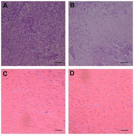 Figure 9 Histologic analysis of tissue response to poly(ethylene glycol)/polylactide fibrous scaffolds. There was a dense accumulation of inflammatory cells presented around the poly(ethylene glycol)/polylactide fibrous scaffolds at 2 weeks (A) but attenuated at week 4 (B). Meanwhile, the surrounding muscle presented good physiological characteristics both at 2 weeks (C) and 4 weeks (D).Note: Scale bar = 50 μm.