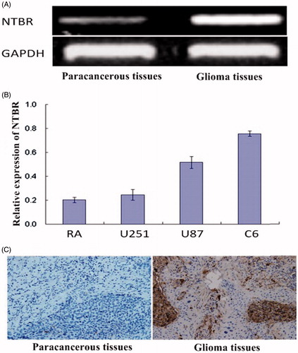 Figure 1. NTBR expression in glioma tissue and glioma cells. (A) RT-PCR was used to detect the expression of NTBR in paracancerous tissues and glioma tissues; (B) NTBR expression in glioma cell lines; (C) NTBR immunohistochemistry was used to detect the expression of NTBR in paracancerous tissues and glial tumours changes in the tumour.