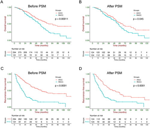 Figure 2. Overall and recurrence-free survival before and after propensity-score matching (PSM). (A,B) The overall survival was significantly better in patients with initial hepatocellular carcinoma (IHCC). (C,D) The recurrence-free survival was significantly better in patients with IHCC. RHCC: recurrent hepatocellular carcinoma.