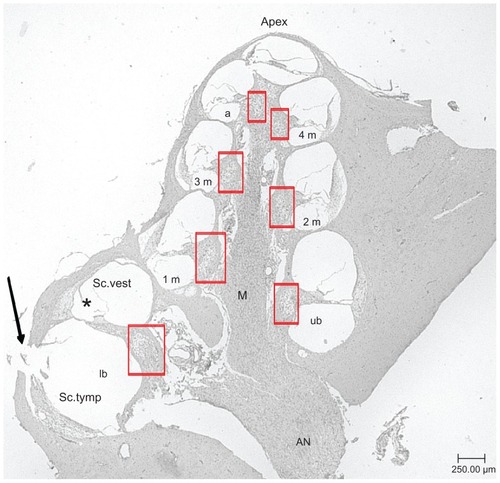 Figure 2 Representative midmodiolar hematoxylin and eosin-stained section (5 μm) of a deafened guinea pig cochlea. Rosenthal’s canal areas are highlighted in red squares. Lower basal turn (lb), upper basal turn (ub), first middle turn (1 m), second middle turn (2 m), third middle turn (3 m), fourth middle turn (4 m), and apical turn (a) of the scala tympani are labeled. The arrow marks the cochleostomy where the solutions were injected into the scala tympani. The modiolus, the axis of the inner ear, and the apex, the upper part of the inner ears are marked.Note: *scala media.Abbreviations: AN, auditory nerve; M, modiolus; Sc. tymp, scala tympani; Sc. vest, scala vestibuli (magnification: 40-fold).