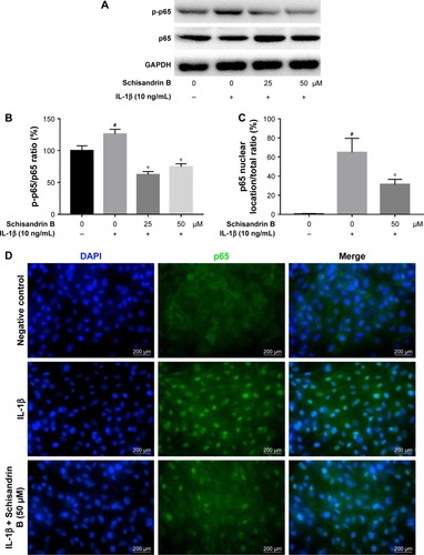 Figure 4 Effect of Schisandrin B on IL-1β-induced NF-κB signal activation in chondrocytes.