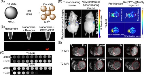 Figure 4 (A) Schematic that MnO2 NPs enhance the magnetic resonance contrast under endogenous stimulation. (B) Optical (above) and fluorescent images (below) of MnO2 nanosheet−sgc8 nanoprobe to target cells. (C) T1- and T2-weighted MRI of MnO2 nanosheet solution treated with GSH. Reproduced with permission from Zhao ZL, Fan HH, Zhou GF, et al. Activatable Fluorescence/MRI Bimodal Platform for Tumor Cell Imaging via MnO2 Nanosheet-Aptamer Nanoprobe. Journal of the American Chemical Society. 2014;136(32):11220–11223.Citation82 Copyright © 2014 American Chemical Society. (D) Phosphorescence images and T2-weighted MR images of a tumor-bearing mouse and a NEM-pretreated tumor-bearing mouse after injected with Ru(BPY)3@MnO2 for 15 mins. Reproduced from Shi W, Song B, Shi W, et al. Bimodal Phosphorescence-Magnetic Resonance Imaging Nanoprobes for Glutathione Based on MnO2 Nanosheet-Ru(II) Complex Nanoarchitecture. ACS Appl Mater Interfaces. 2018;10(33):27681–27691.Citation83 Copyright © 2018 American Chemical Society. (E) T1- and T2-MRI of tumors with Fe3O4@C@MnO2 NPs. Reproduced from Duan B, Wang D, Wu H, et al. Core–Shell Structurized Fe3O4@C@MnO2 Nanoparticles as pH Responsive T1-T2* Dual-Modal Contrast Agents for Tumor Diagnosis. ACS Biomaterials Science & Engineering. 2018;4(8):3047–3054.Citation84 Copyright © 2018 American Chemical Society.Abbreviation: NEM, N-ethylmaleimide.