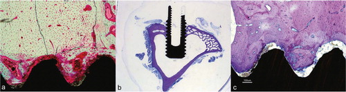 Figure 33. Photomicrographs of HA-coated implants: a) 6-week bulk staining with basic fuchsine. b) Overview of the 52-week sample demonstrating the shape and position of the screw and the macroscopic appearance. c) Magnification of the 52-week HA screw. Toluidine blue routine histological staining in b) and c).