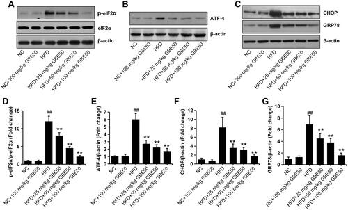 Figure 6 GBE50 attenuated endoplasmic reticulum stress in HFD-fed mice. (A–C) Representative Western blot bands of the expressions of p-eIF2α, eIF2α, ATF-4, CHOP and GRP78 in liver tissues in various of groups. (D–G) The quantification of the expression levels of p-eIF2 (D), ATF-4 (E), CHOP (F) and GRP78 (G). All data are presented as mean±SD, n=6 mice/group, **P<0.01 vs HFD alone group; ##P<0.01 vs NC group.