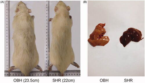 Figure 2. (A) Morphological change of OBH rats compared with SHR rats after HFD exposure for 10 weeks. (B) Different sizes and colours of livers compared with SHR rats after 10 weeks of HFD exposure.