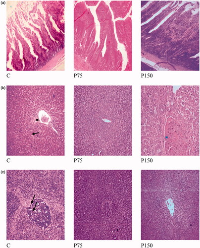 Figure 3. (a) Effect of dietary supplementation of pyocyanin on ileum histomorphology of broiler chickens (H&E × 100). C: control group, P75: 75 mg pyocyanin/kg diet and P150: 150 mg pyocyanin/kg diet. (b) Liver of broiler chickens as affected by dietary supplementation of pyocyanin (H&E × 400) showing normal hepatic parenchyma, note the normal hepatocytes and blood sinusoids with slight dilatation of hepatoportal blood vessel in C (black arrow head), congestion of hepatoportal blood vessel in P150 (blue arrow head), blood sinusoids showing mononuclear cells permeation in C (black arrows). C: control group, P75: 75 mg pyocyanin/kg diet and P150: 150 mg pyocyanin/kg diet. (c) Spleen of broiler chickens as affected by dietary supplementation of pyocyanin (H&E × 200) showing normal lymphoid follicles with normal white and red bulbs and with slight vacuolation in C (arrows). C: control group, P75: 75 mg pyocyanin/kg diet and P150: 150 mg pyocyanin/kg diet.