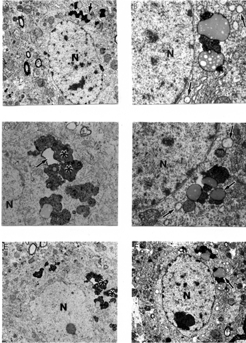 Figure 6 Ultrastructural characteristics of the neuronal damage in AβPP-YAC transgenic mouse hippocampus. Mitochondrial lesions were associated with lipofuscin formation in the neuronal cell body (asterisk) and mitochondria appeared to be a major substrate for lipofuscin formation (single arrows). Original magnification: A, E, and F ×5,000. B, C, and D ×20,000 respectively.