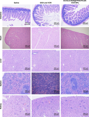 Figure S7 The comparison of in vivo toxicity efficiency on major organs between DOX and VCR and CS-ALG-DOX@TPGS-PLGA-VCR NPs.Note: Pathological sections of the organs were stained with H&E stain method.Abbreviations: CS, chitosan; ALG, alginate; DOX, doxorubicin; TPGS, vitamin E d-α-tocopheryl polyethylene glycol 1000 succinate; PLGA, poly(lactic-co-glycolic acid); VCR, vincristine; CS-ALG-DOX NPs, chitosan-alginate nanoparticles carrying doxorubicin; TPGS-PLGA-VCR NPs, vitamin E d-α-tocopheryl polyethylene glycol 1000 succinate-modified poly(lactic-co-glycolic acid) nanoparticles carrying vincristine; H&E, hematoxylin and eosin.