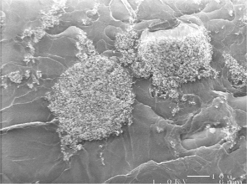 Figure 3. Low‐voltage scanning electron micrograph depicting particle agglomerate in microcomposite cement (scale bar represents 10 μm).